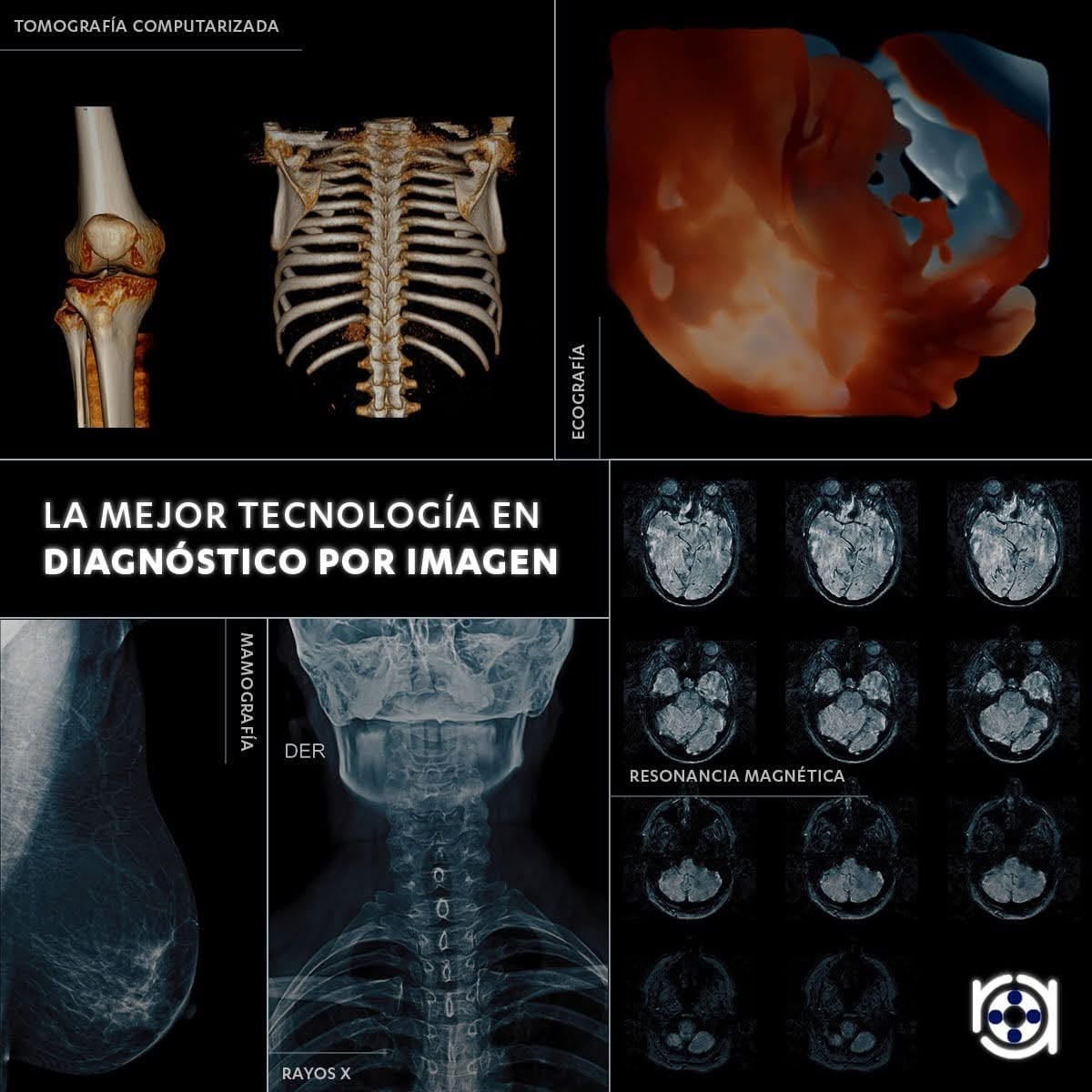 radiogrrafía quito